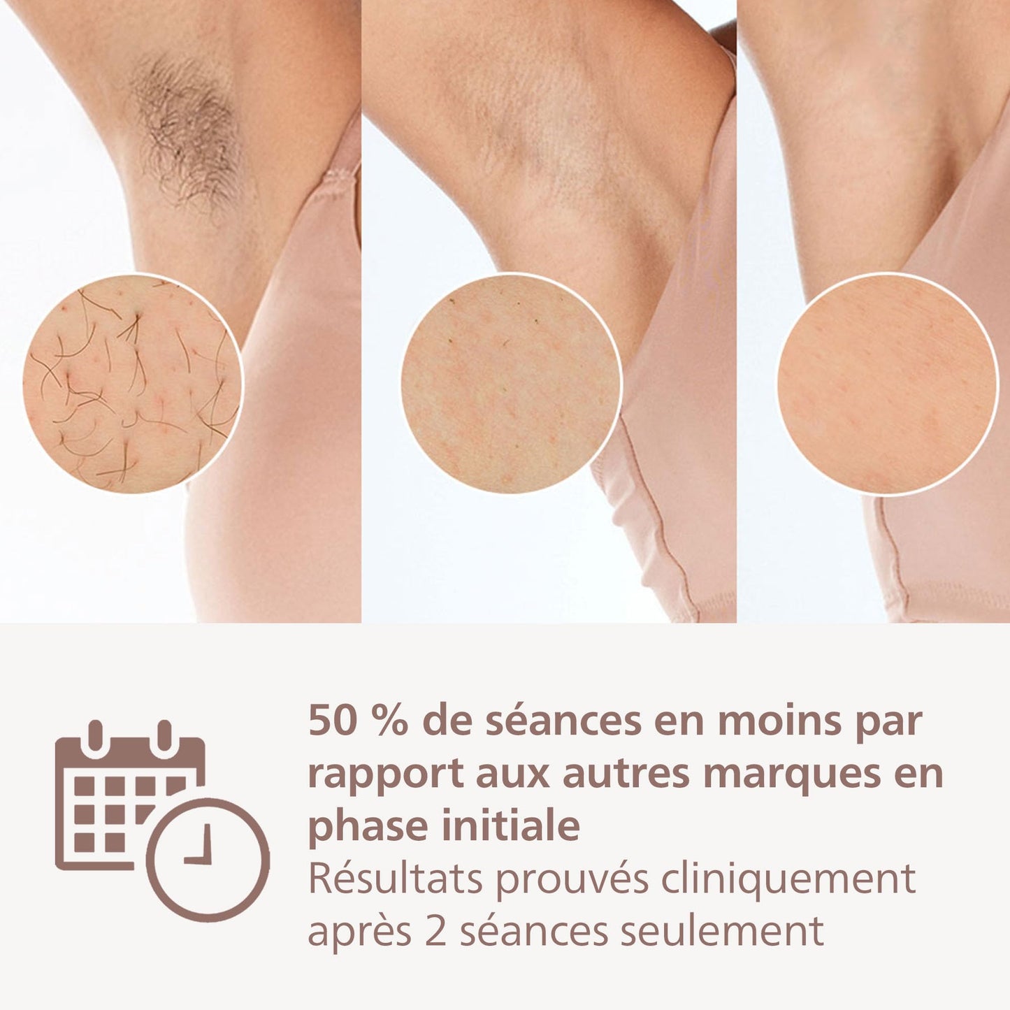 Philips Lumea Série 9900, épilateur à lumière pulsée, technologie SenseIQ et SkinAI, 4 embouts pour le corps, le visage, le maillot et les aisselles, utilisation avec et sans fil (modèle BRI951/00)