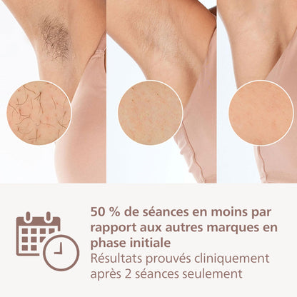 Philips Lumea Série 9900, épilateur à lumière pulsée, technologie SenseIQ et SkinAI, 4 embouts pour le corps, le visage, le maillot et les aisselles, utilisation avec et sans fil (modèle BRI951/00)